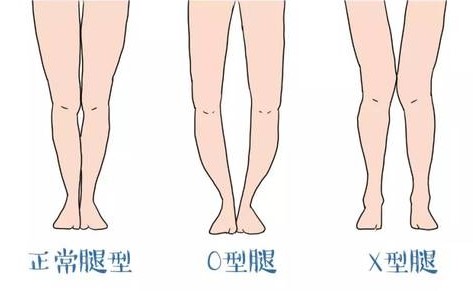 腿型介绍图片